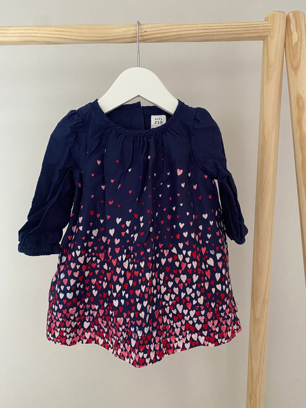 GAP Dress (3-6 Months)