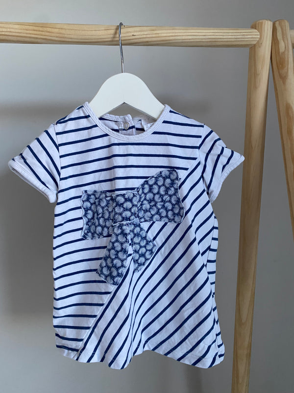 H&M Top (18-24 Months)